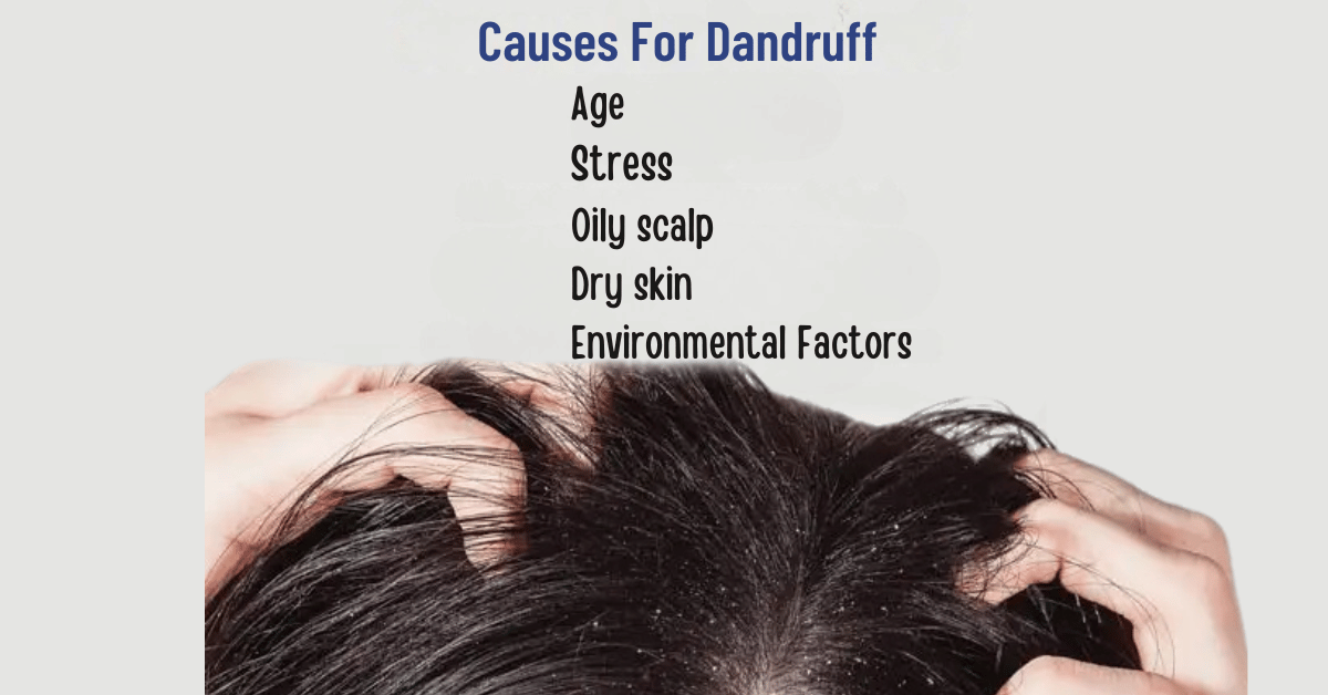 Who Can Get Dandruff