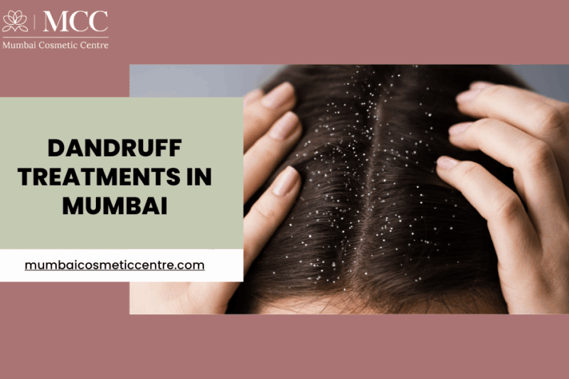 Dandruff Treatments in Mumbai for Healthy, Flake-Free Hair