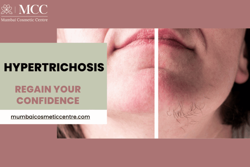 Effective Treatments for Hypertrichosis: Regain Your Confidence