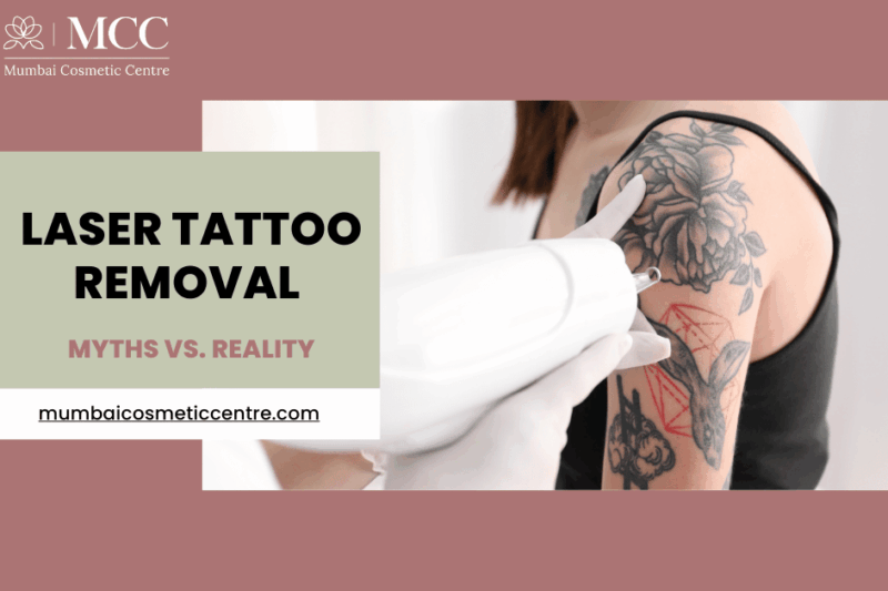 Does Laser Tattoo Removal Hurt? Myths vs. Reality