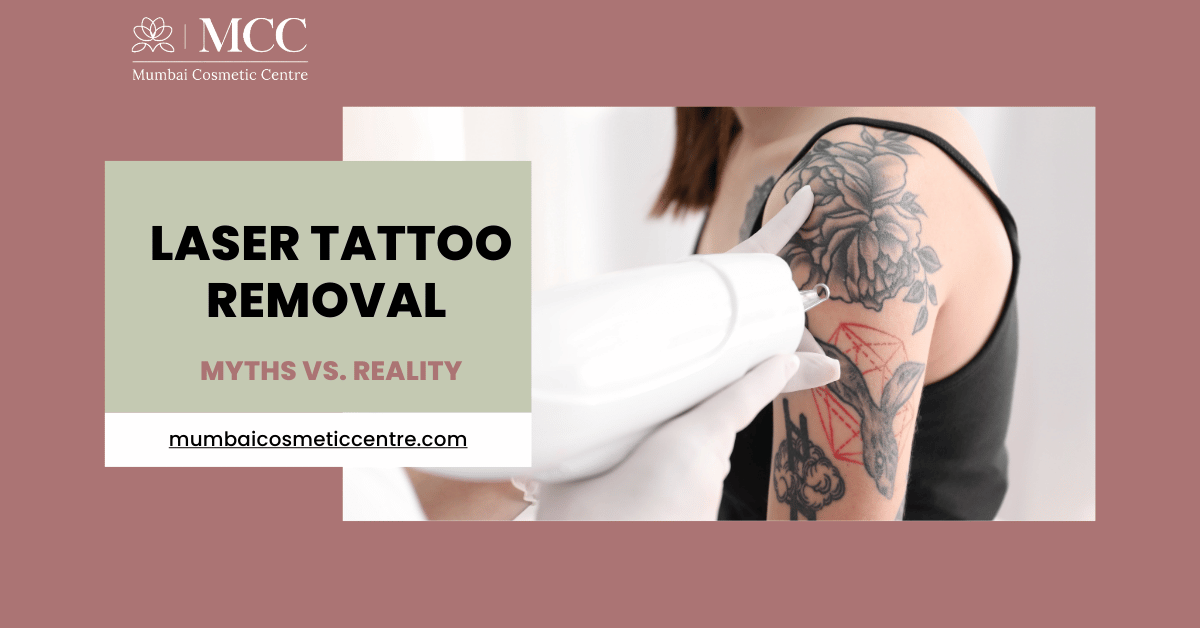 Does Laser Tattoo Removal Hurt? Myths vs. Reality