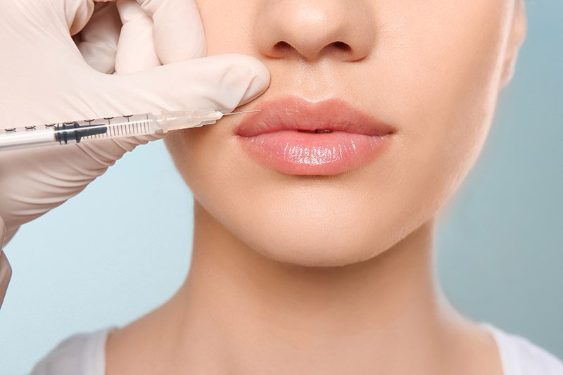 What Are Natural-Looking Fillers?