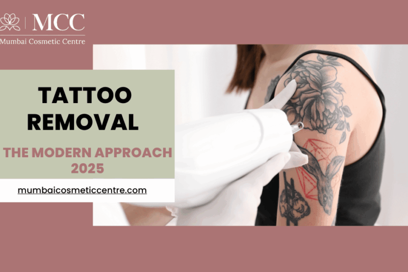 The Modern Approach to Tattoo Removal Service in 2025