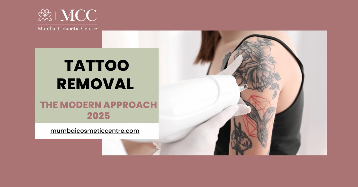 The Modern Approach to Tattoo Removal Service in 2025