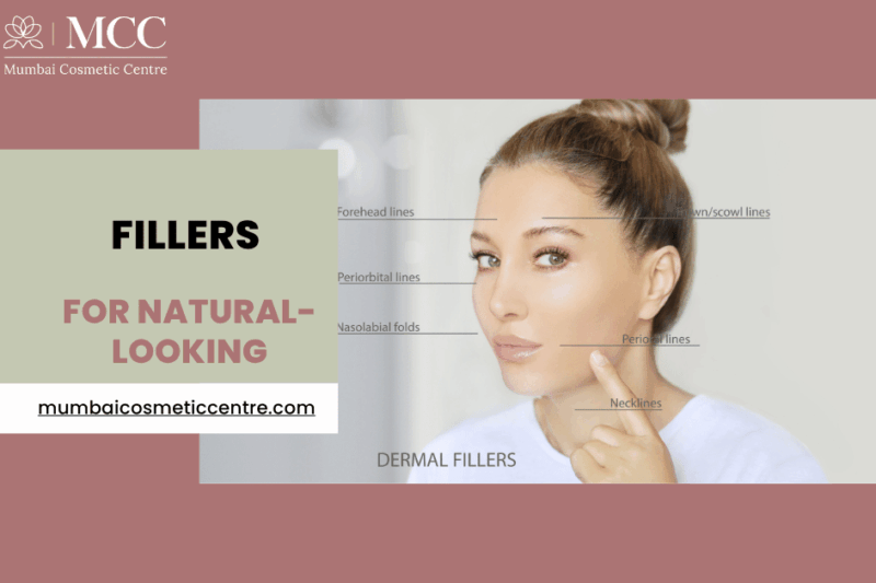 Natural-Looking Fillers That Enhance, Not Change