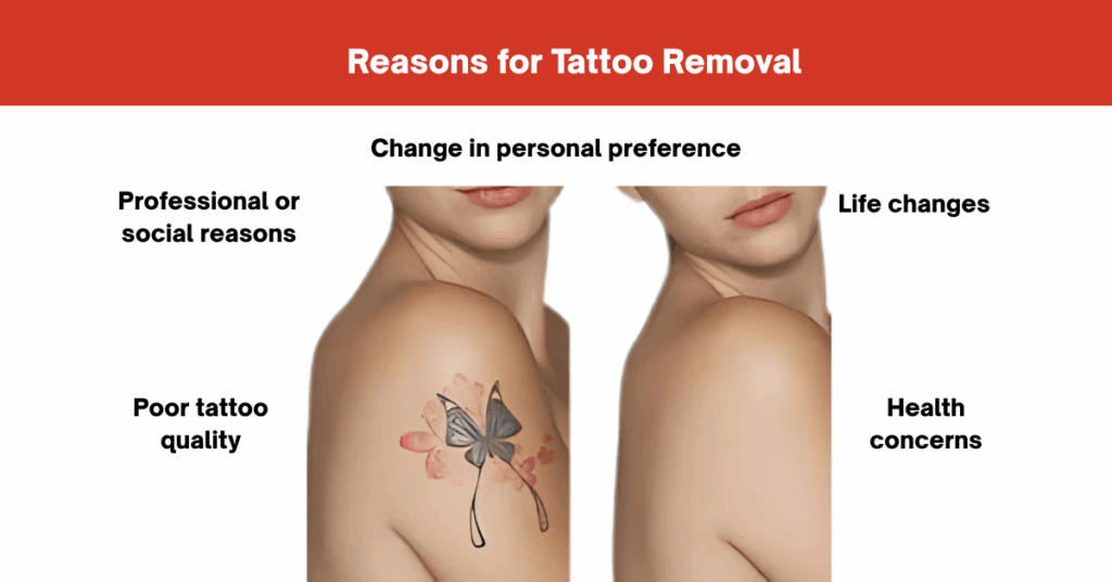 Reasons and Common Concerns for Tattoo Removal
