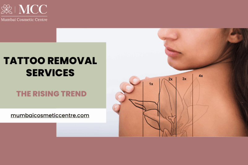 The Rising Trend of Tattoo Removal Services