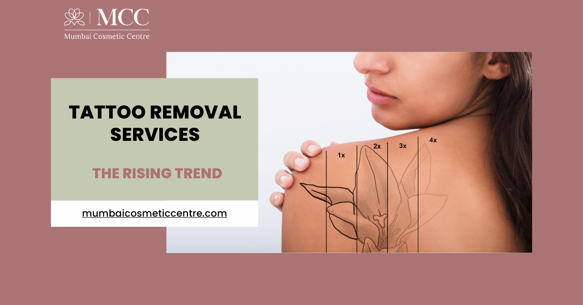 The Rising Trend of Tattoo Removal Services
