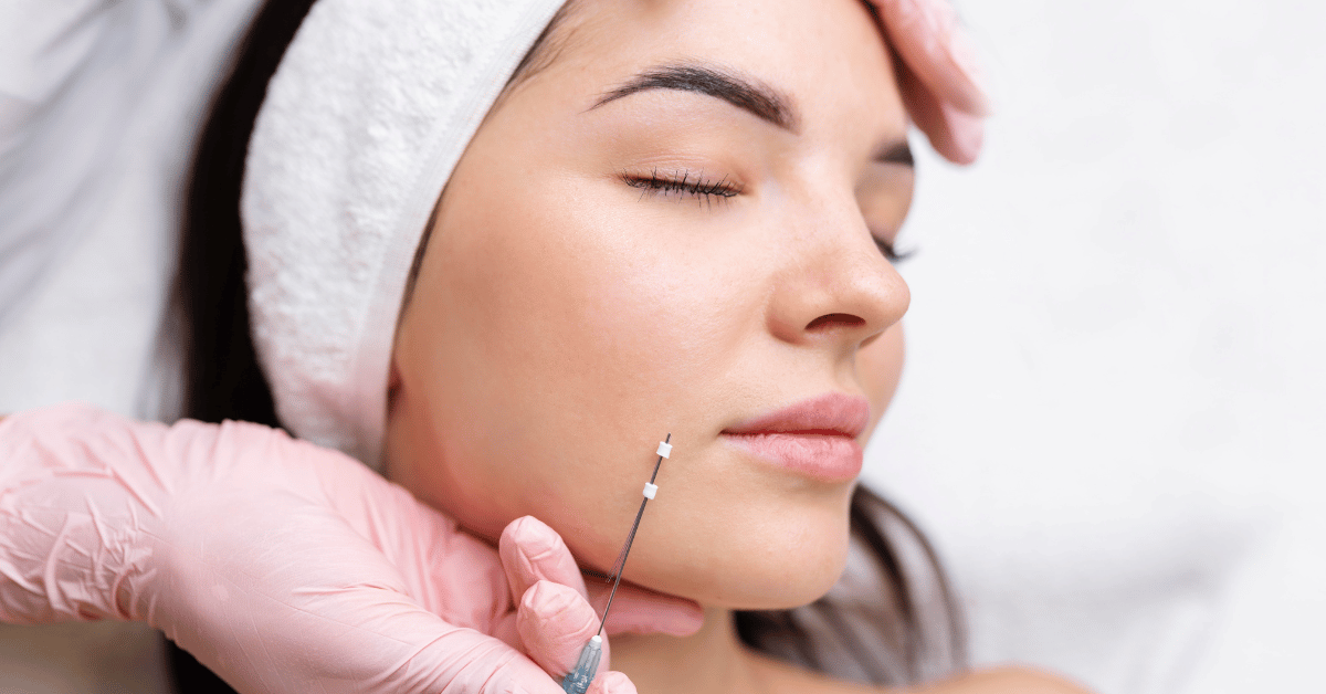 What is a Thread Lift?