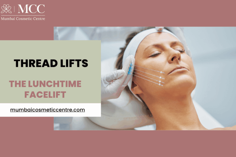 Thread Lifts: The Lunchtime Facelift