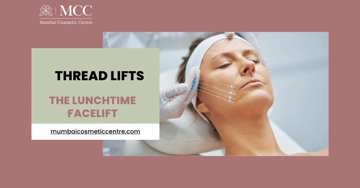 Thread Lifts: The Lunchtime Facelift