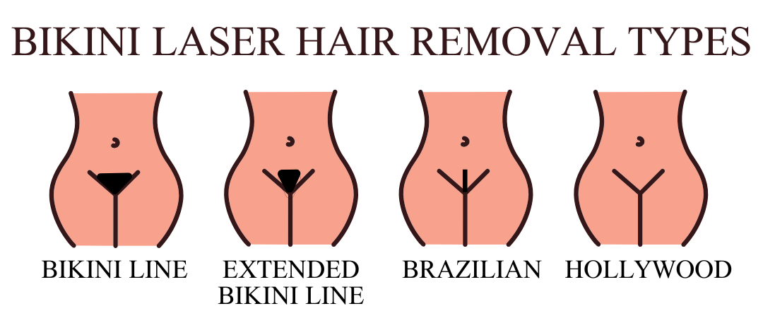 Different Bikini Laser Hair Removal Styles