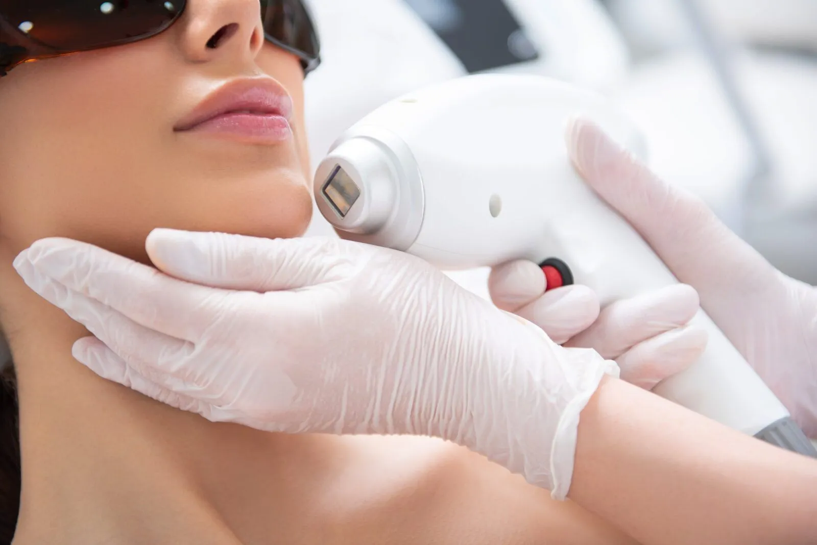 face laser treatment in Mumbai Cosmetic Centre