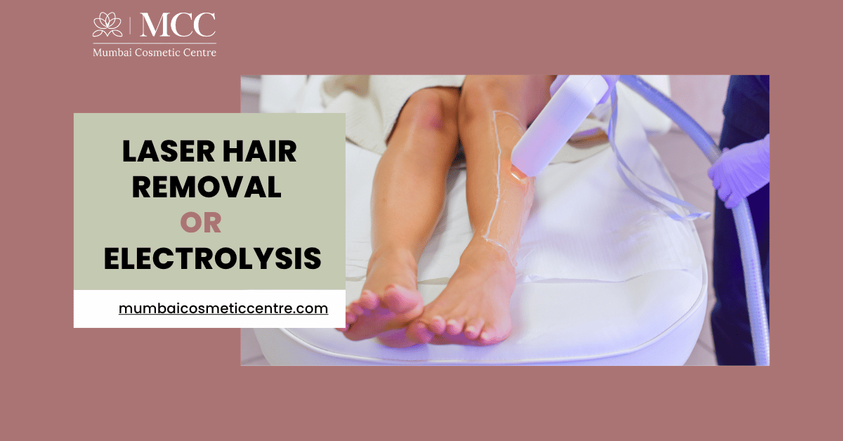 Laser hair removal or electrolysis: Which one is best?