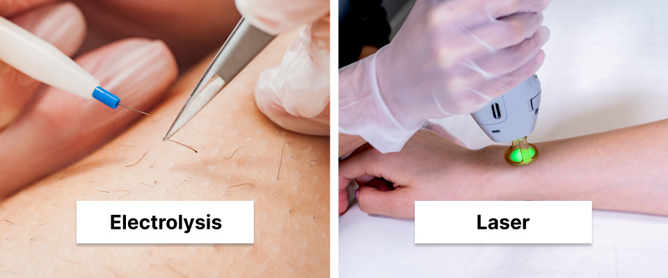 Laser hair removal vs electrolysis, learn at Mumbai Cosmetic Centre