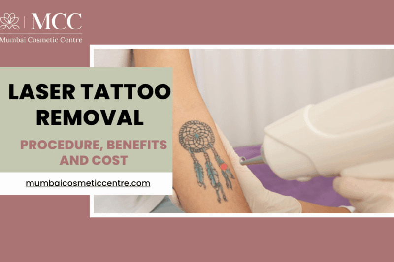 Laser Tattoo Removal Procedure, Benefits, and Cost