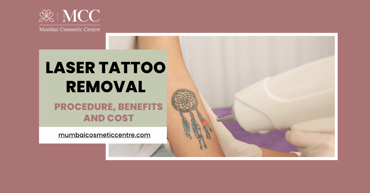 Laser Tattoo Removal Procedure, Benefits, and Cost