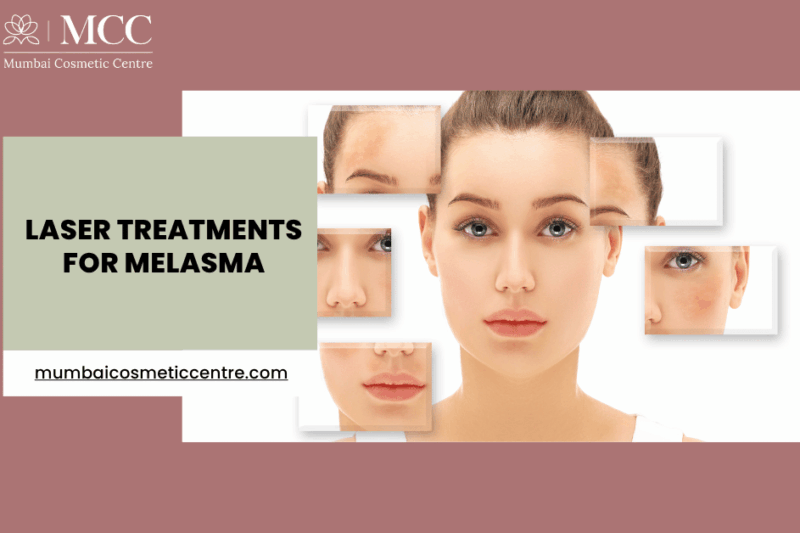 Laser Treatments for Melasma in Mumbai