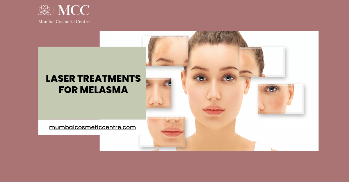 Laser Treatments for Melasma in Mumbai