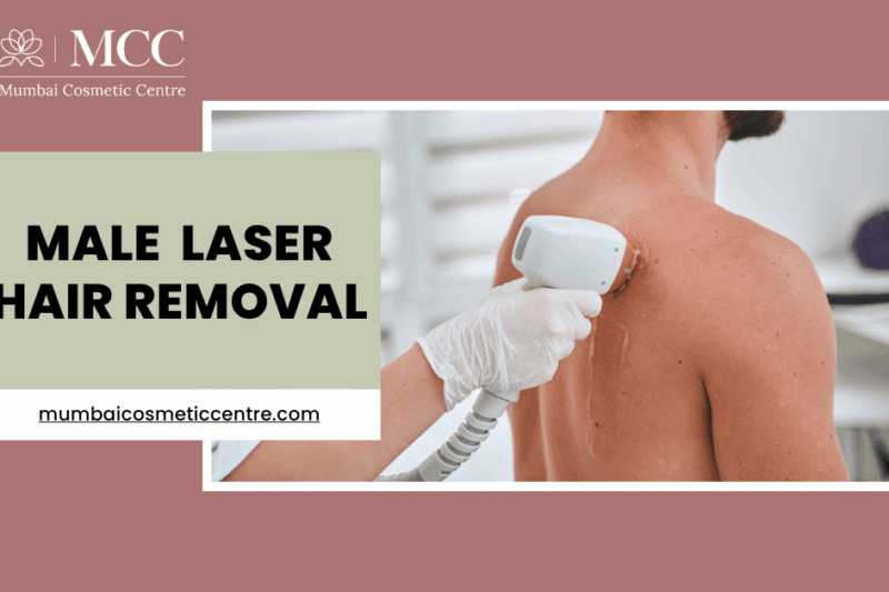 Smooth Skin, No Razor: Male Laser Hair Removal Explained