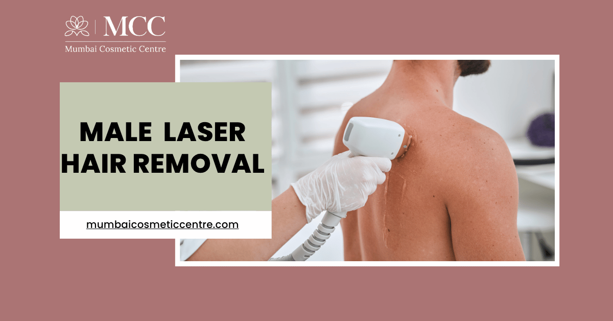 Smooth Skin, No Razor: Male Laser Hair Removal Explained