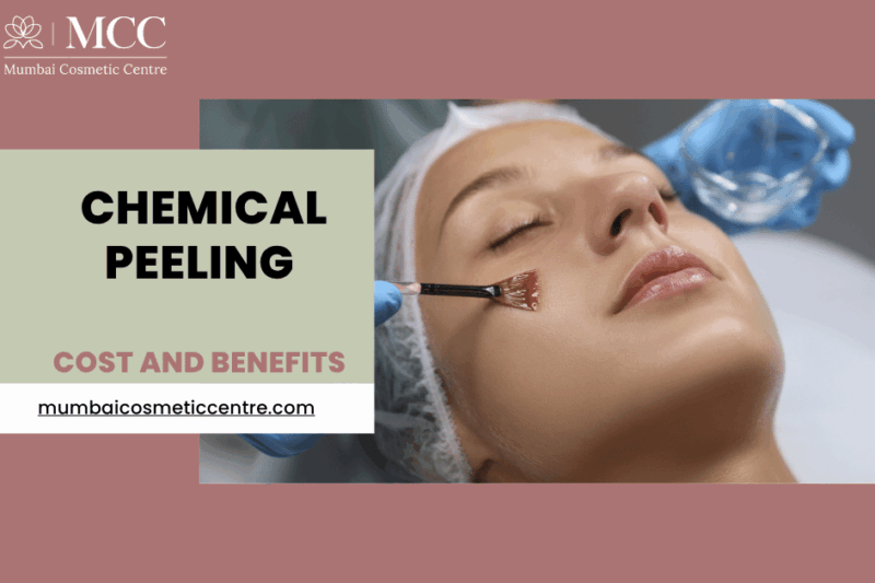 Chemical Peeling Treatment in Mumbai: Cost and Benefits