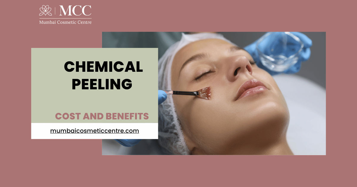Chemical Peeling Treatment in Mumbai: Cost and Benefits