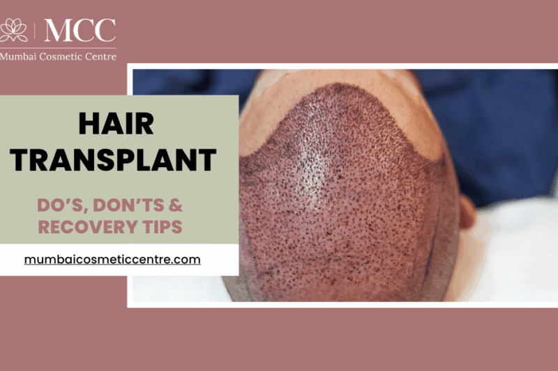 Hair Transplant Aftercare in Mumbai: Do’s, Don’ts & Recovery Tips