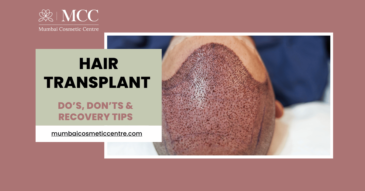 Hair Transplant Aftercare in Mumbai: Do’s, Don’ts & Recovery Tips