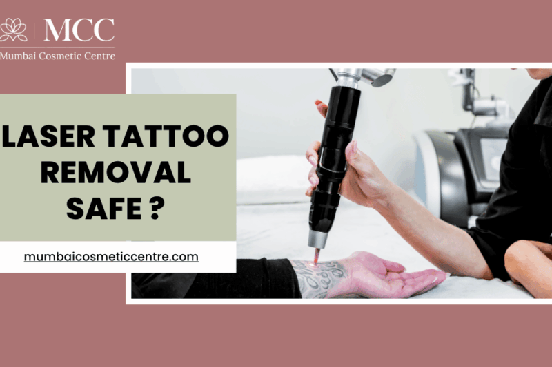 Is Laser Tattoo Removal Safe in Mumbai?