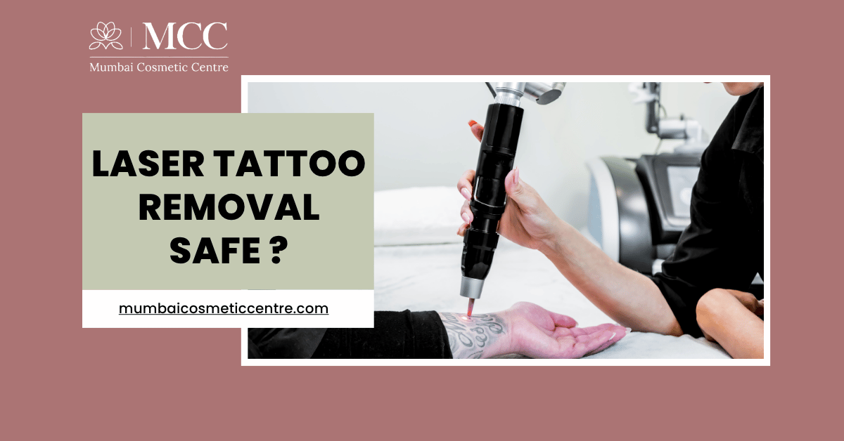 Is Laser Tattoo Removal Safe in Mumbai?