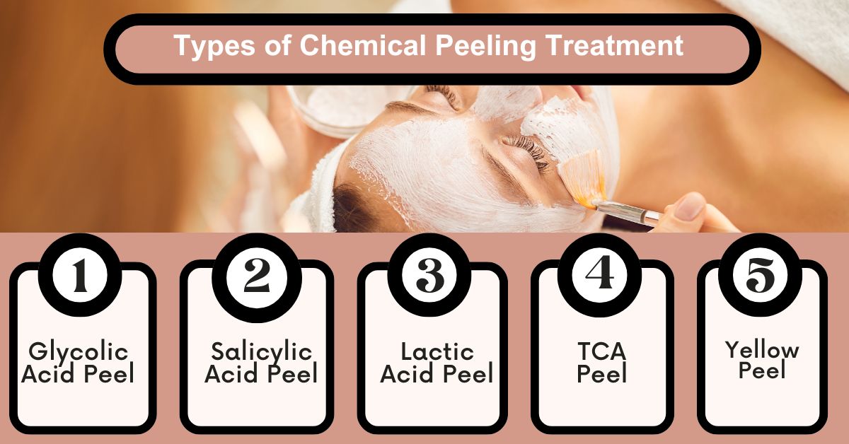 Types of Chemical Peeling Treatment in Mumbai
