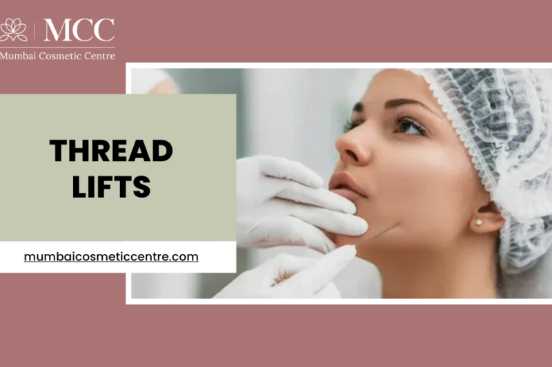 Thread Lifts: The Lunchtime Facelift