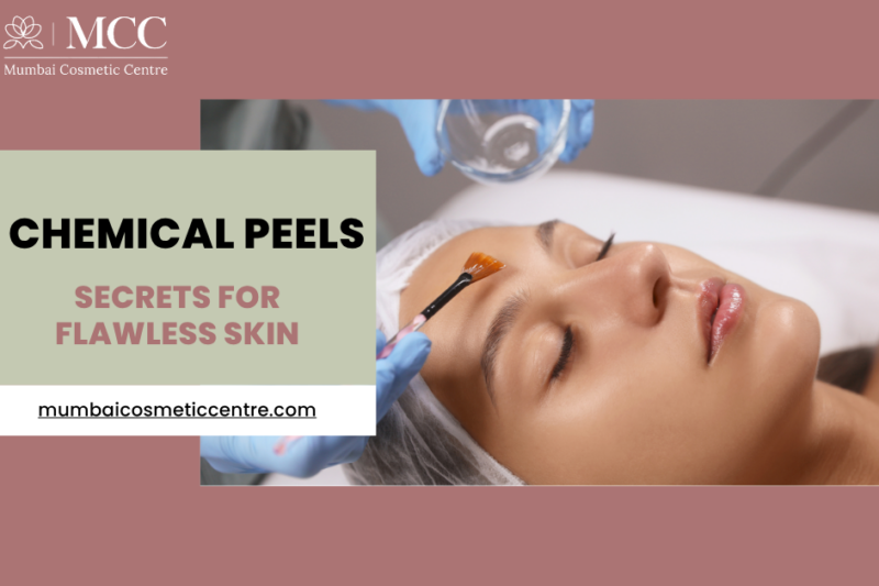 Chemical Peel Secrets for Flawless Skin