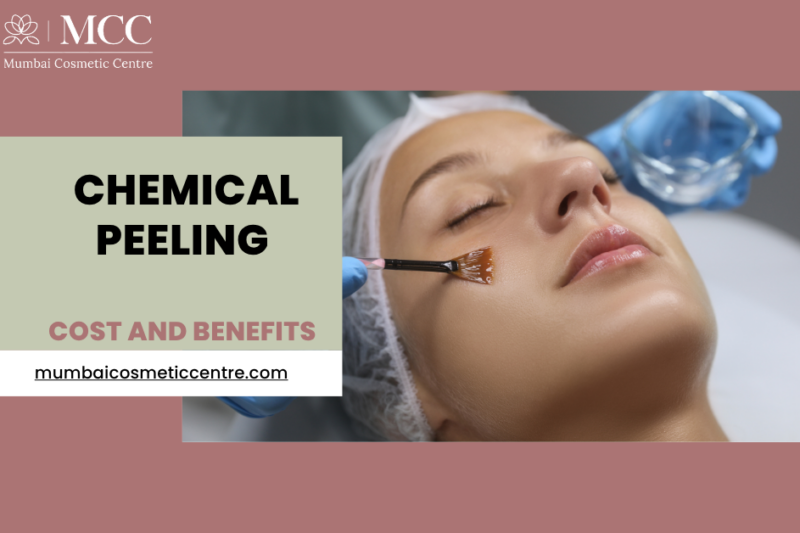 Chemical Peeling Treatment in Mumbai: Cost and Benefits