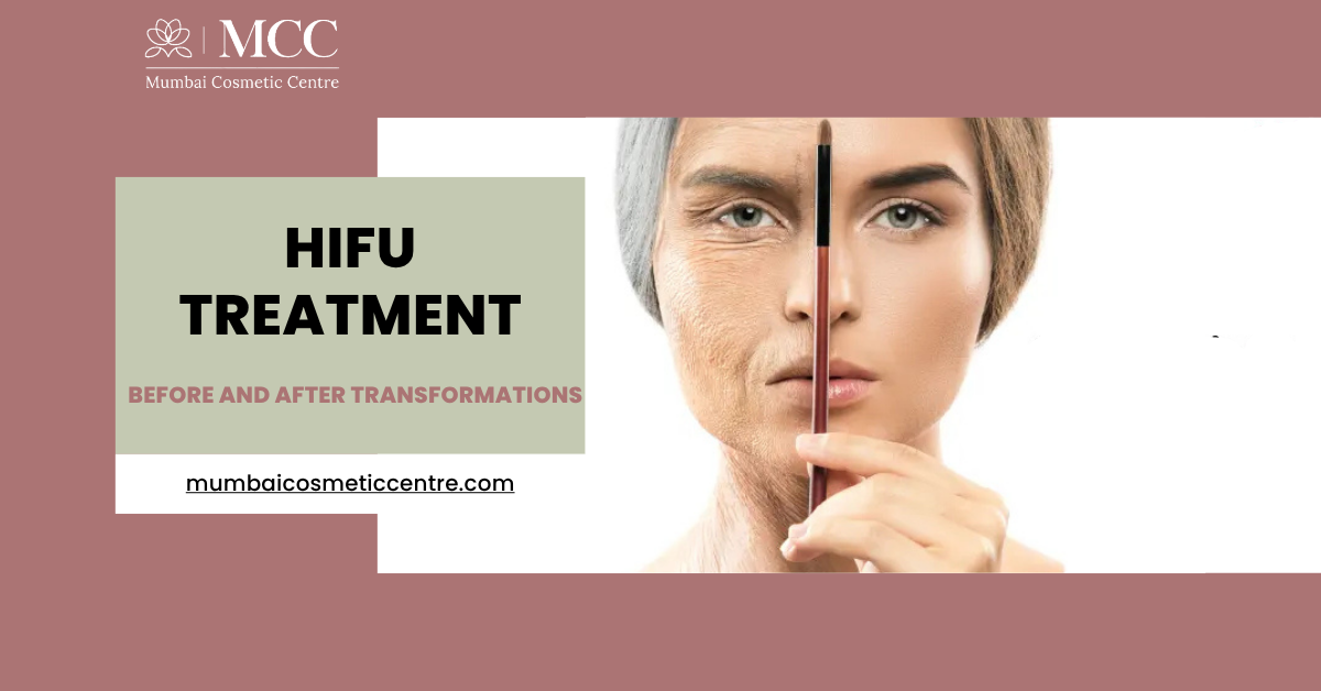 hifutreatmentbeforeandaftertransformationsinmumbai