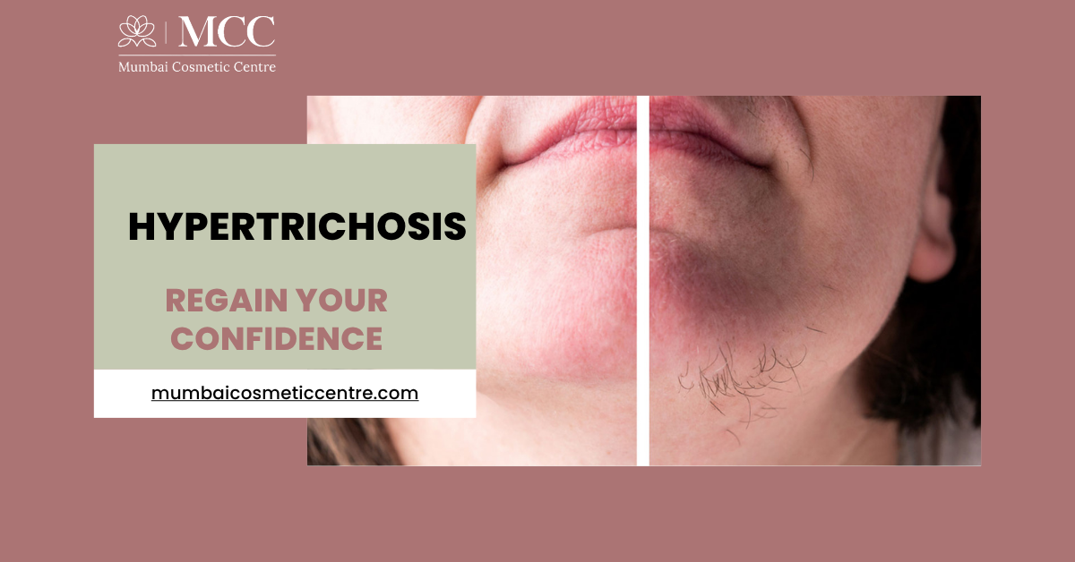 hypertrichosis-treatment-options.png