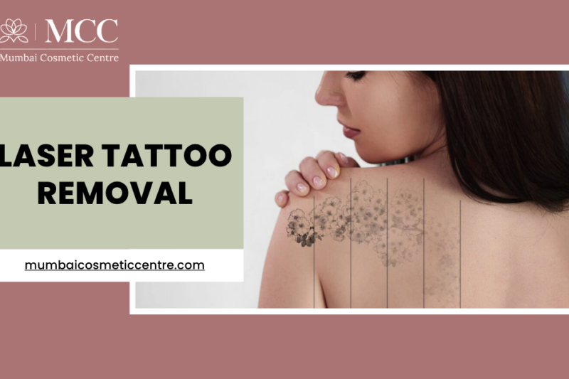 Is Laser Tattoo Removal Safe in Mumbai?