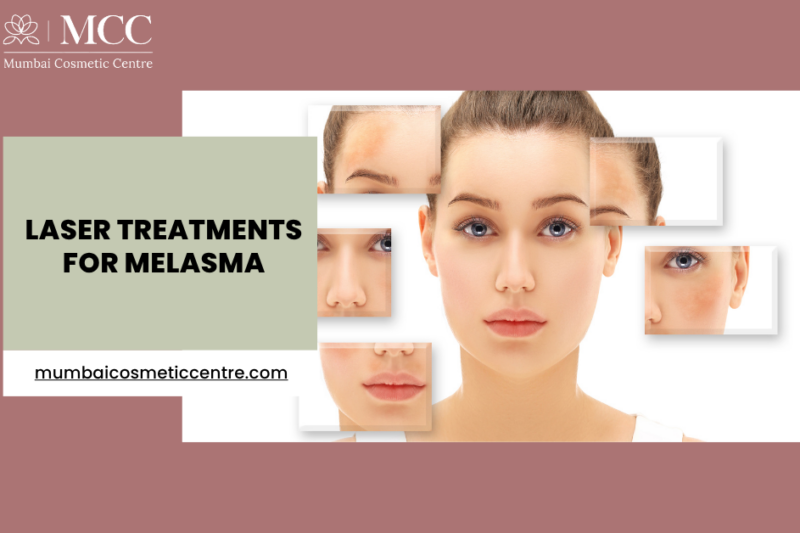 Laser Treatments for Melasma in Mumbai