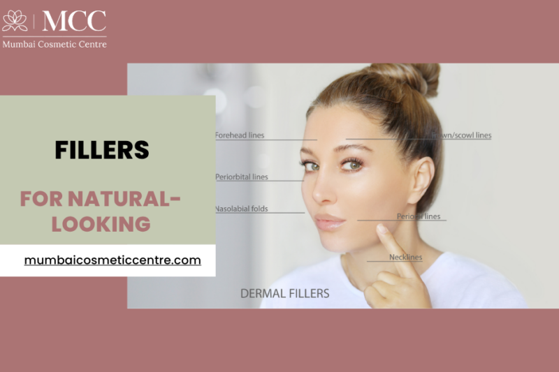 Natural-Looking Fillers That Enhance, Not Change