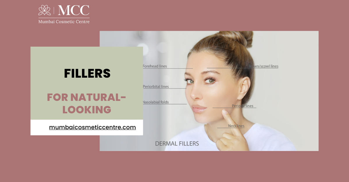 natural looking filers enhance