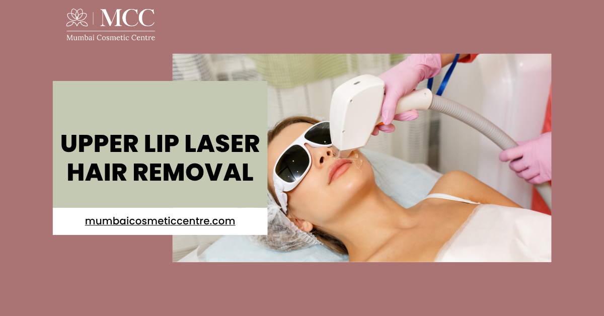 upper-lip-laser-treatment-guide.png