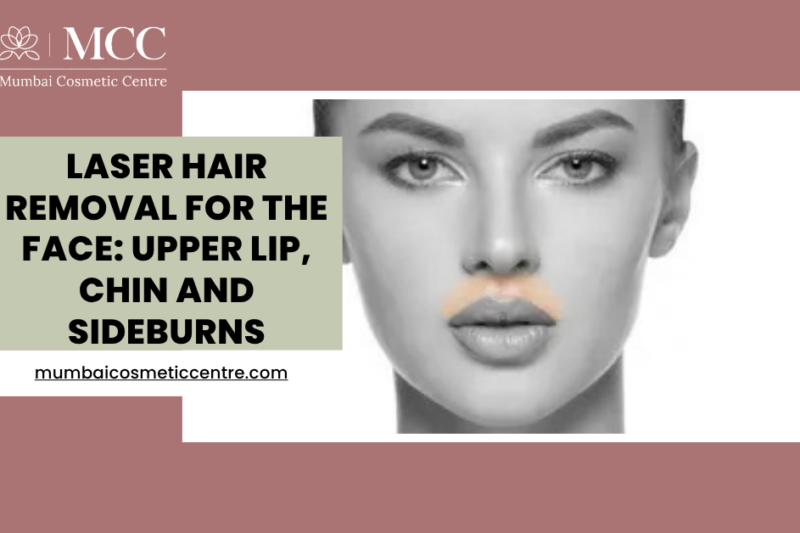 Laser Hair Removal for the Face: Upper Lip, Chin and Sideburns