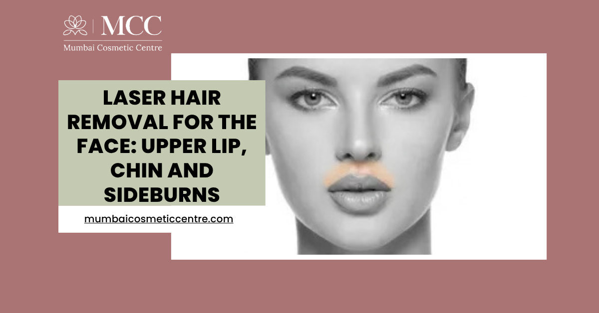 Laser Hair Removal for the Face: Upper Lip, Chin and Sideburns