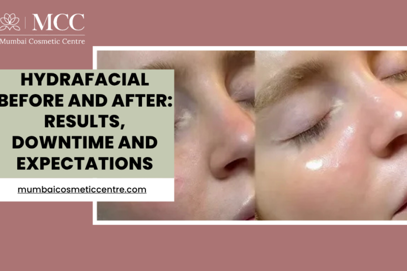 HydraFacial Before and After: Results, Downtime and Expectations