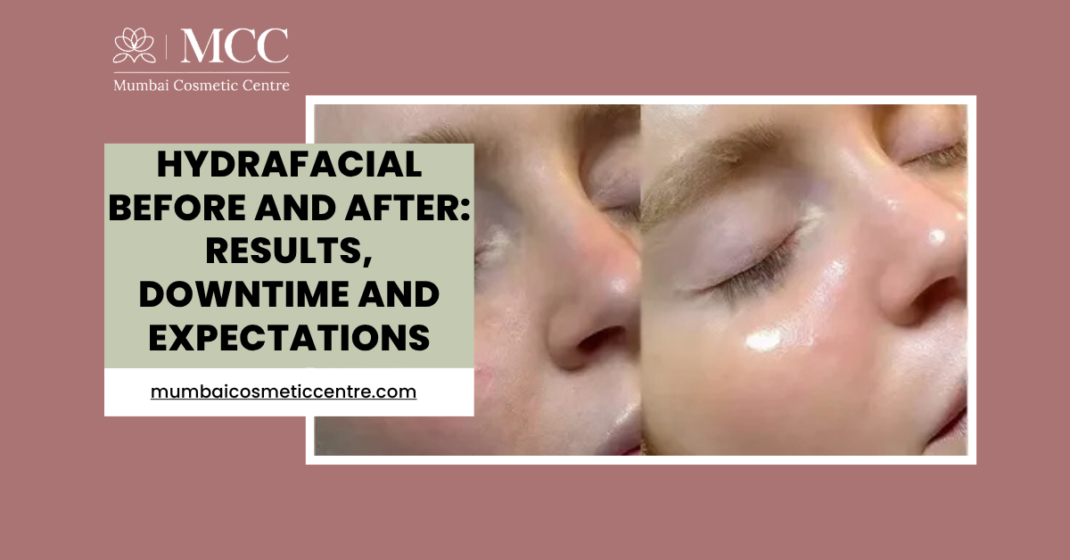 HydraFacial Before and After: Results, Downtime and Expectations