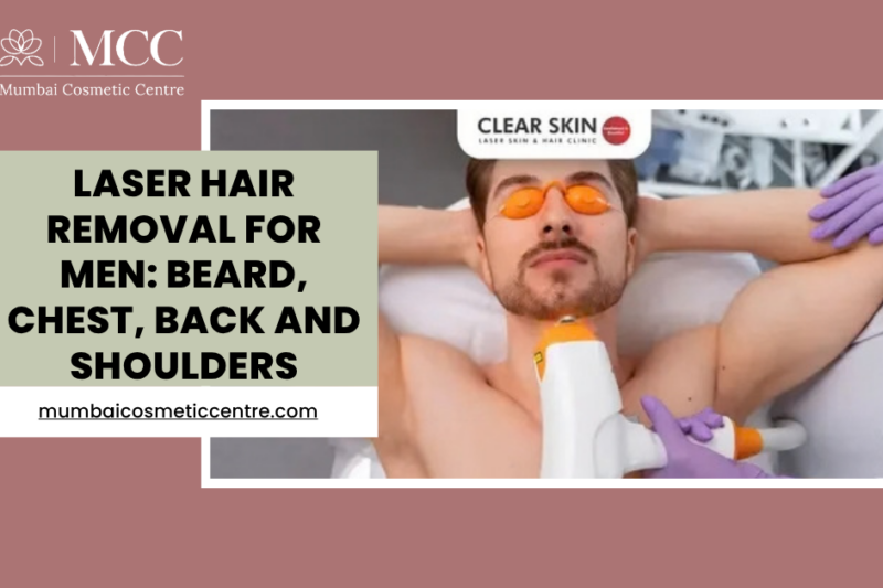 Laser Hair Removal for Men: Beard, Chest, Back and Shoulders