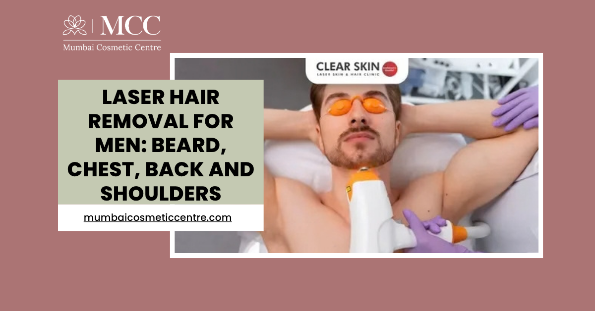 Laser Hair Removal for Men: Beard, Chest, Back and Shoulders