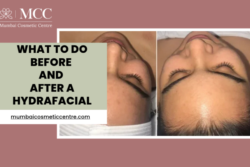What to Do Before and After a HydraFacial